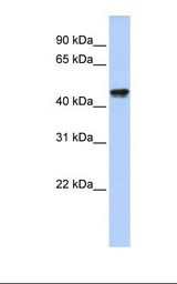 QTRTD1 Antibody - Fetal heart lysate. Antibody concentration: 1.0 ug/ml. Gel concentration: 12%.  This image was taken for the unconjugated form of this product. Other forms have not been tested.