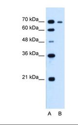 R1 / RRM1 Antibody - Lane A: Marker. Lane B: HepG2 cell lysate. Antibody concentration: 1.25 ug/ml. Gel concentration: 12%.  This image was taken for the unconjugated form of this product. Other forms have not been tested.