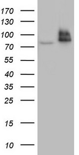 R1 / RRM1 Antibody - HEK293T cells were transfected with the pCMV6-ENTRY control. (Left lane) or pCMV6-ENTRY RRM1. (Right lane) cDNA for 48 hrs and lysed. Equivalent amounts of cell lysates. (5 ug per lane) were separated by SDS-PAGE and immunoblotted with anti-RRM1.