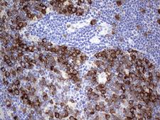 R1 / RRM1 Antibody - Immunohistochemical staining of paraffin-embedded Human lymph node tissue within the normal limits using anti-RRM1 Mouse monoclonal antibody.  heat-induced epitope retrieval by 1 mM EDTA in 10mM Tris, pH8.5, 120C for 3min)