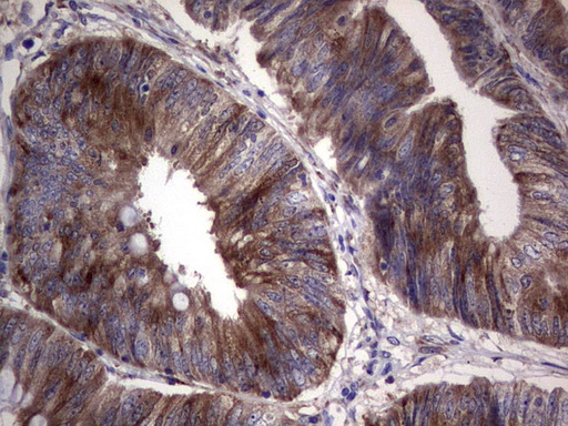 R1 / RRM1 Antibody - Immunohistochemical staining of paraffin-embedded Human colon tissue within the normal limits using anti-RRM1 mouse monoclonal antibody. (Heat-induced epitope retrieval by 1 mM EDTA in 10mM Tris, pH8.5, 120C for 3min,
