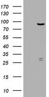 R1 / RRM1 Antibody - HEK293T cells were transfected with the pCMV6-ENTRY control (Left lane) or pCMV6-ENTRY RRM1 (Right lane) cDNA for 48 hrs and lysed. Equivalent amounts of cell lysates (5 ug per lane) were separated by SDS-PAGE and immunoblotted with anti-RRM1.