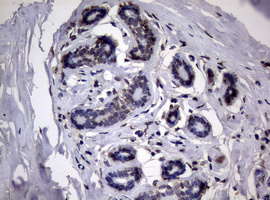 R1 / RRM1 Antibody - IHC of paraffin-embedded Human breast tissue using anti-RRM1 mouse monoclonal antibody.