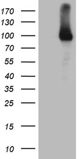 R1 / RRM1 Antibody - HEK293T cells were transfected with the pCMV6-ENTRY control. (Left lane) or pCMV6-ENTRY RRM1. (Right lane) cDNA for 48 hrs and lysed. Equivalent amounts of cell lysates. (5 ug per lane) were separated by SDS-PAGE and immunoblotted with anti-RRM1. (1:500)