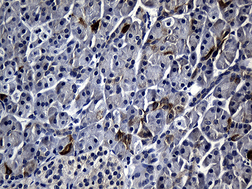 R1 / RRM1 Antibody - Immunohistochemical staining of paraffin-embedded Human pancreas tissue within the normal limits using anti-RRM1 mouse monoclonal antibody. (Heat-induced epitope retrieval by 1mM EDTA in 10mM Tris buffer. (pH8.5) at 120°C for 3 min. (1:500)