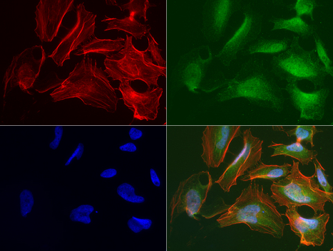 R1 / RRM1 Antibody - Immunofluorescent staining of HeLa cells using anti-RRM1 mouse monoclonal antibody  green, 1:50). Actin filaments were labeled with Alexa Fluor® 594 Phalloidin. (red), and nuclear with DAPI. (blue).
