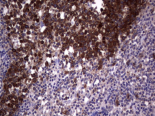 R1 / RRM1 Antibody - Immunohistochemical staining of paraffin-embedded Human tonsil using anti-RRM1 mouse monoclonal antibody.  heat-induced epitope retrieval by 1 mM EDTA in 10mM Tris, pH8.5, 120C for 3min)