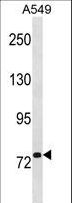 R1 / RRM1 Antibody - RRM1 Antibody western blot of A549 cell line lysates (35 ug/lane). The RRM1 antibody detected the RRM1 protein (arrow).