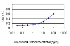 R1 / RRM1 Antibody - Detection limit for recombinant GST tagged RRM1 is approximately 0.3 ng/ml as a capture antibody.