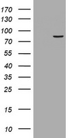 R1 / RRM1 Antibody - HEK293T cells were transfected with the pCMV6-ENTRY control (Left lane) or pCMV6-ENTRY RRM1 (Right lane) cDNA for 48 hrs and lysed. Equivalent amounts of cell lysates (5 ug per lane) were separated by SDS-PAGE and immunoblotted with anti-RRM1.