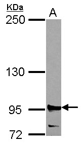 R1 / RRM1 Antibody - Sample (30 ug of whole cell lysate) A: 293T 5% SDS PAGE RRM1 antibody diluted at 1:2000