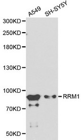 R1 / RRM1 Antibody - Western blot of RRM1 pAb in extracts from A549 and SH-SY5Y cells.