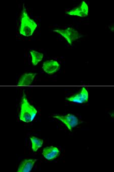 R1 / RRM1 Antibody - Immunofluorescence analysis of HeLa cell using RRM1 antibody. Blue: DAPI for nuclear staining.