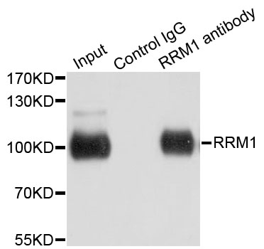 R1 / RRM1 Antibody - Immunoprecipitation analysis of 200ug extracts of HeLa cells.