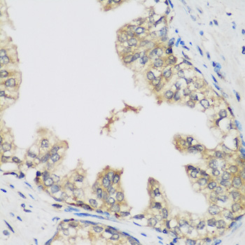 R1 / RRM1 Antibody - Immunohistochemistry of paraffin-embedded human prostate using RRM1 antibodyat dilution of 1:200 (40x lens).