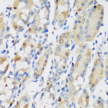 R1 / RRM1 Antibody - Immunohistochemistry of paraffin-embedded human stomach using RRM1 antibodyat dilution of 1:200 (40x lens).