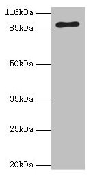 R1 / RRM1 Antibody - Western blot All lanes: RRM1 antibody at 2µg/ml + Hela whole cell lysate Secondary Goat polyclonal to rabbit IgG at 1/10000 dilution Predicted band size: 90 kDa Observed band size: 90 kDa