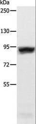 R1 / RRM1 Antibody - Western blot analysis of HeLa cell, using RRM1 Polyclonal Antibody at dilution of 1:600.