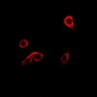 R1 / RRM1 Antibody - Immunofluorescent analysis of RRM1 staining in HeLa cells. Formalin-fixed cells were permeabilized with 0.1% Triton X-100 in TBS for 5-10 minutes and blocked with 3% BSA-PBS for 30 minutes at room temperature. Cells were probed with the primary antibody in 3% BSA-PBS and incubated overnight at 4 deg C in a humidified chamber. Cells were washed with PBST and incubated with a DyLight 594-conjugated secondary antibody (red) in PBS at room temperature in the dark.