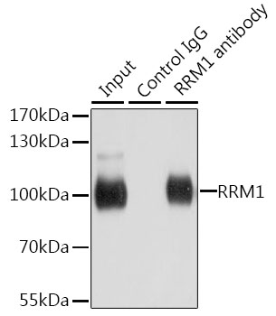 R1 / RRM1 Antibody - Immunoprecipitation analysis of 200ug extracts of HeLa cells using 1ug RRM1 antibody. Western blot was performed from the immunoprecipitate using RRM1 antibody at a dilition of 1:500.