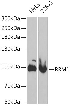 R1 / RRM1 Antibody - Western blot analysis of extracts of various cell lines, using RRM1 antibody at 1:1000 dilution. The secondary antibody used was an HRP Goat Anti-Rabbit IgG (H+L) at 1:10000 dilution. Lysates were loaded 25ug per lane and 3% nonfat dry milk in TBST was used for blocking.