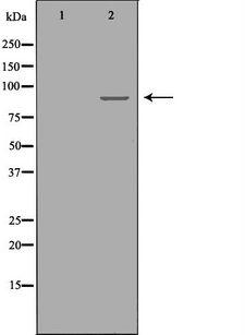 R1 / RRM1 Antibody - Western blot analysis of A549 cells using RRM1 antibody. The lane on the left is treated with the antigen-specific peptide.