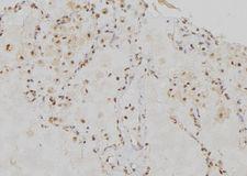 R1 / RRM1 Antibody - 1:100 staining human lung tissue by IHC-P. The sample was formaldehyde fixed and a heat mediated antigen retrieval step in citrate buffer was performed. The sample was then blocked and incubated with the antibody for 1.5 hours at 22°C. An HRP conjugated goat anti-rabbit antibody was used as the secondary.