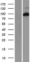 R1 / RRM1 Protein - Western validation with an anti-DDK antibody * L: Control HEK293 lysate R: Over-expression lysate