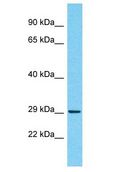 R3HCC1 Antibody - R3HCC1 antibody Western Blot of MCF7. Antibody dilution: 1 ug/ml.  This image was taken for the unconjugated form of this product. Other forms have not been tested.