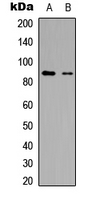 R3HCC1L / C10orf28 Antibody - Western blot analysis of R3HCC1L expression in HepG2 (A); Jurkat (B) whole cell lysates.