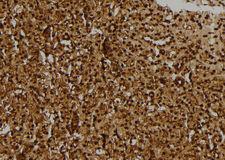 R3HCC1L / C10orf28 Antibody - 1:100 staining rat kidney tissue by IHC-P. The sample was formaldehyde fixed and a heat mediated antigen retrieval step in citrate buffer was performed. The sample was then blocked and incubated with the antibody for 1.5 hours at 22°C. An HRP conjugated goat anti-rabbit antibody was used as the secondary.
