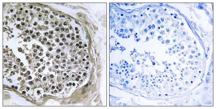 R3HCC1L / C10orf28 Antibody - Peptide - + Immunohistochemistry analysis of paraffin-embedded human tesophagusis tissue using GIDRP88 antibody.