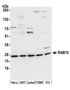 RAB10 Antibody - Detection of human and mouse RAB10 by western blot. Samples: Whole cell lysate (50 µg) from HeLa, HEK293T, Jurkat, mouse TCMK-1, and mouse NIH 3T3 cells prepared using NETN lysis buffer. Antibody: Affinity purified rabbit anti-RAB10 antibody used for WB at 0.1 µg/ml. Detection: Chemiluminescence with an exposure time of 10 seconds.
