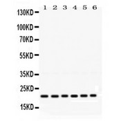RAB10 Antibody - RAB10 antibody Western blot. All lanes: Anti RAB10 at 0.5 ug/ml. Lane 1: Rat Brain Tissue Lysate at 50 ug. Lane 2: Mouse Thymus Tissue Lysate at 50 ug. Lane 3: Mouse Brain Tissue Lysate at 50 ug. Lane 4: HELA Whole Cell Lysate at 40 ug. Lane 5: MCF-7 Whole Cell Lysate at 40 ug. Lane 6: COLO320 Whole Cell Lysate at 40 ug. Predicted band size: 22 kD. Observed band size: 22 kD.