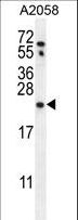 RAB10 Antibody - RAB10 Antibody western blot of A2058 cell line lysates (35 ug/lane). The RAB10 antibody detected the RAB10 protein (arrow).