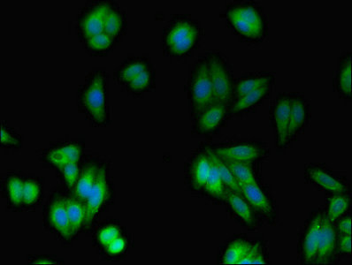 RAB10 Antibody - Immunofluorescent analysis of HepG2 cells using RAB10 Antibody at dilution of 1:100 and Alexa Fluor 488-congugated AffiniPure Goat Anti-Rabbit IgG(H+L)