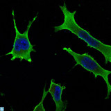 RAB10 Antibody - Immunofluorescence (IF) analysis of LOVO cells using Rab 10 Monoclonal Antibody (green). Blue: DRAQ5 fluorescent DNA dye.