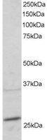 RAB11A Antibody - RAB11A antibody staining (2 ug/ml) of mouse heart lysate (RIPA buffer, 30g total protein per lane). Primary incubated for 1 hour. Detected by Western blot of chemiluminescence.