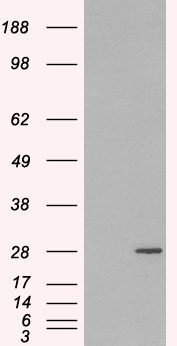 RAB11A Antibody - HEK293 overexpressing RAB11A(RC200352) and probed with (mock transfection in first lane).