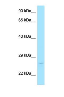 RAB11A Antibody - RAB11A antibody Western blot of 721_B Cell lysate. Antibody concentration 1 ug/ml.  This image was taken for the unconjugated form of this product. Other forms have not been tested.
