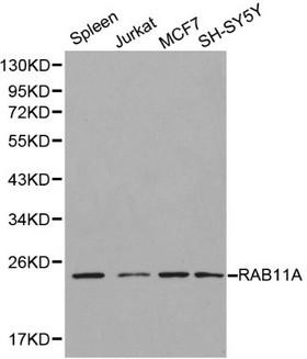 RAB11A Antibody - Western blot of RAB11A pAb in extracts from mouse spleen tissue and Jurkat, MCF7, SH-SY5Y cells.
