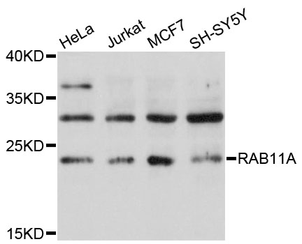 RAB11A Antibody - Western blot analysis of extracts of various cell lines, using RAB11A antibody at 1:1000 dilution. The secondary antibody used was an HRP Goat Anti-Rabbit IgG (H+L) at 1:10000 dilution. Lysates were loaded 25ug per lane and 3% nonfat dry milk in TBST was used for blocking. An ECL Kit was used for detection and the exposure time was 10s.