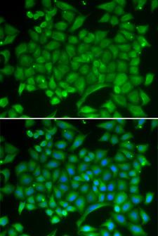 RAB11A Antibody - Immunofluorescence analysis of MCF-7 cells using RAB11A antibody. Blue: DAPI for nuclear staining.