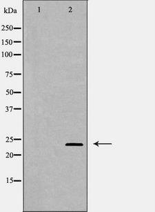 RAB11A Antibody - Western blot analysis of HeLa whole cells lysates using RAB11A antibody. The lane on the left is treated with the antigen-specific peptide.