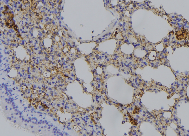 RAB11A Antibody - 1:100 staining mouse lung tissue by IHC-P. The sample was formaldehyde fixed and a heat mediated antigen retrieval step in citrate buffer was performed. The sample was then blocked and incubated with the antibody for 1.5 hours at 22°C. An HRP conjugated goat anti-rabbit antibody was used as the secondary.