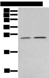 RAB11A Antibody - Western blot analysis of Human fetal brain tissue 231 cell  using RAB11A Polyclonal Antibody at dilution of 1:400