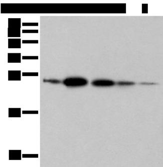 RAB11A Antibody - Western blot analysis of 293T A549 and 231 cell Human fetal brain tissue Human placenta tissue  using RAB11A Polyclonal Antibody at dilution of 1:500