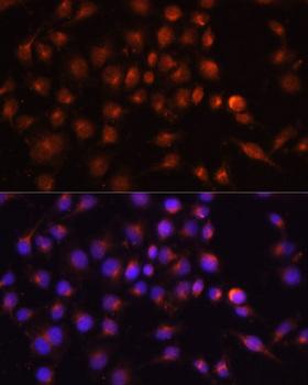 RAB11A Antibody - Immunofluorescence analysis of HeLa cells using RAB11A Polyclonal Antibody at dilution of 1:100.Blue: DAPI for nuclear staining.