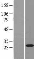 RAB11A Protein - Western validation with an anti-DDK antibody * L: Control HEK293 lysate R: Over-expression lysate