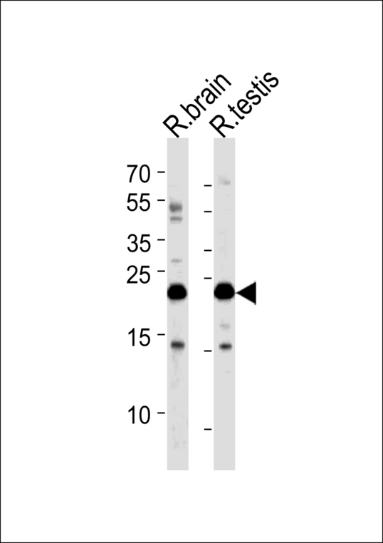 RAB11B Antibody - (RAT) Rab11b Antibody western blot of rat brain and testis tissue lysates (35 ug/lane). The (RAT) Rab11b antibody detected the (RAT) Rab11b protein (arrow).